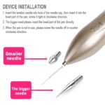 Stylo laser anti-tâches brunes du visage, dispositif pour enlever les taches foncées de la peau, outil de soin – Image 5