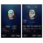 Machine professionnelle de Microneedling RF 2-en-1 avec Marteau Froid – 200 W – Image 4